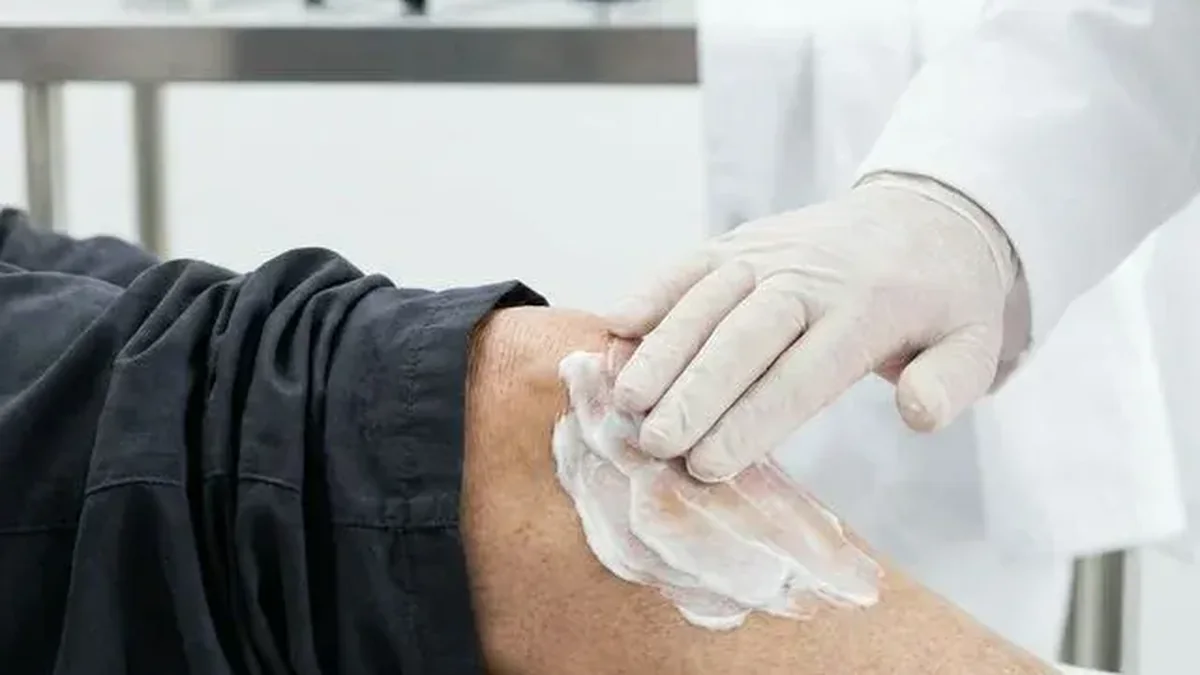Síndrome patelofemoral (Dolor anterior de rótula): Rozamiento al bajar escaleras - Dossier Científico Artro-Salud